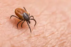 New Lyme disease test that uses AI could lead to earlier diagnosis