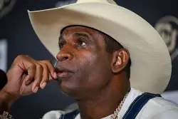 How surgeons build a new bladder for cancer patients like Deion Sanders